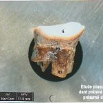 Conférence « Analyse des restes présumés de Bayard ? »