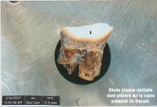 Conférence « Analyse des restes présumés de Bayard ? »