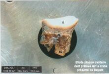 Estimation de l’âge de Bayard à sa mort